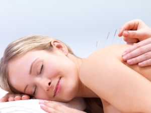 Acupuncture and Relaxation